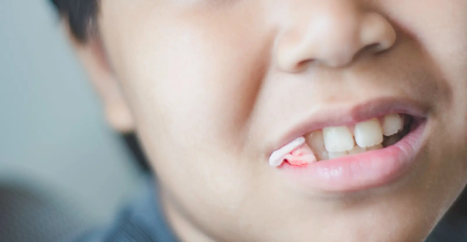 after tooth extraction