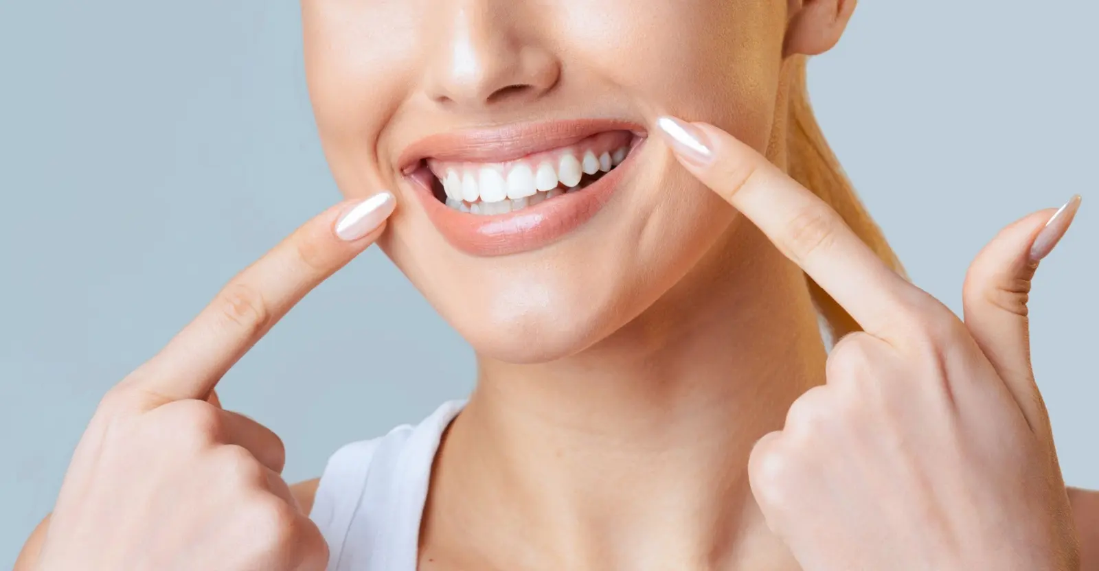 smile makeovers