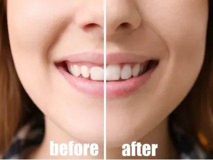 Typical Procedures Done by an Oral Surgery - At  Implant and Facial Surgery