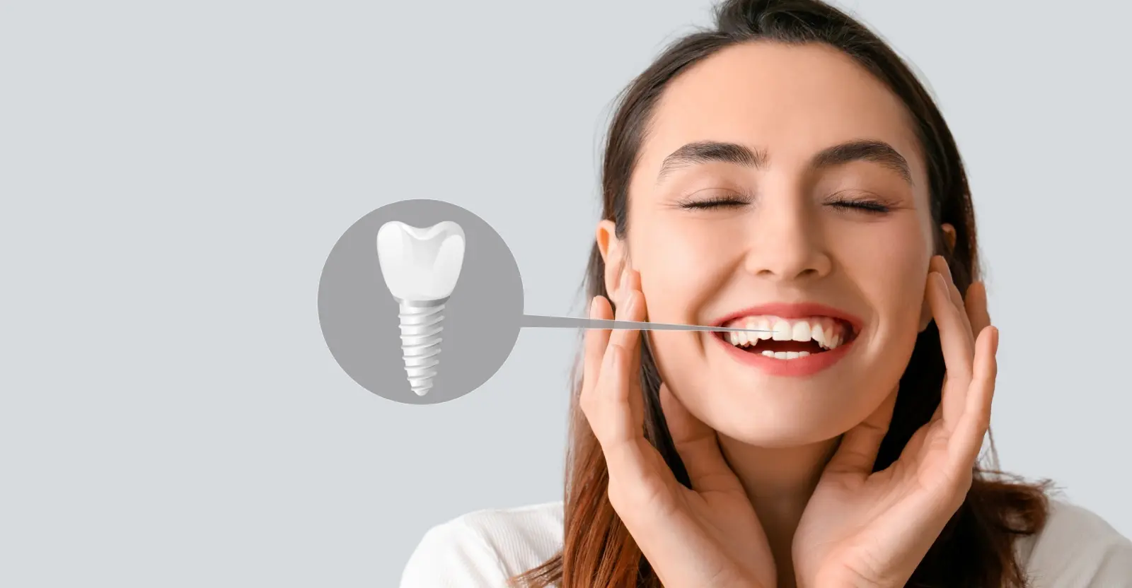 Candidate for Dental Implants Hero- Implant and Facial Surgery