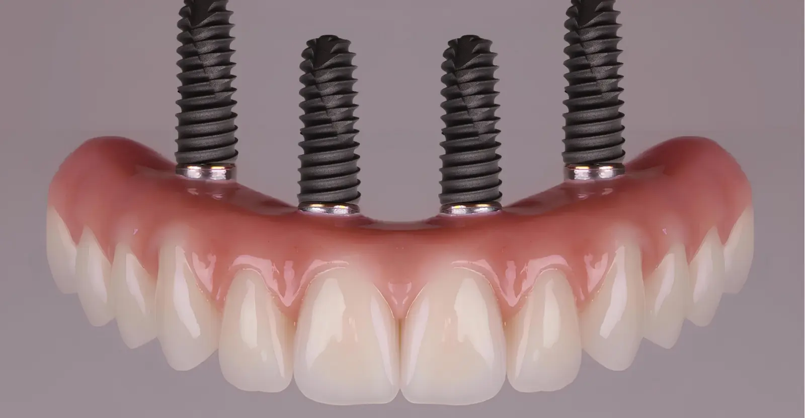 All-on-4 Dental Implants hero - Implant and Facial Surgery