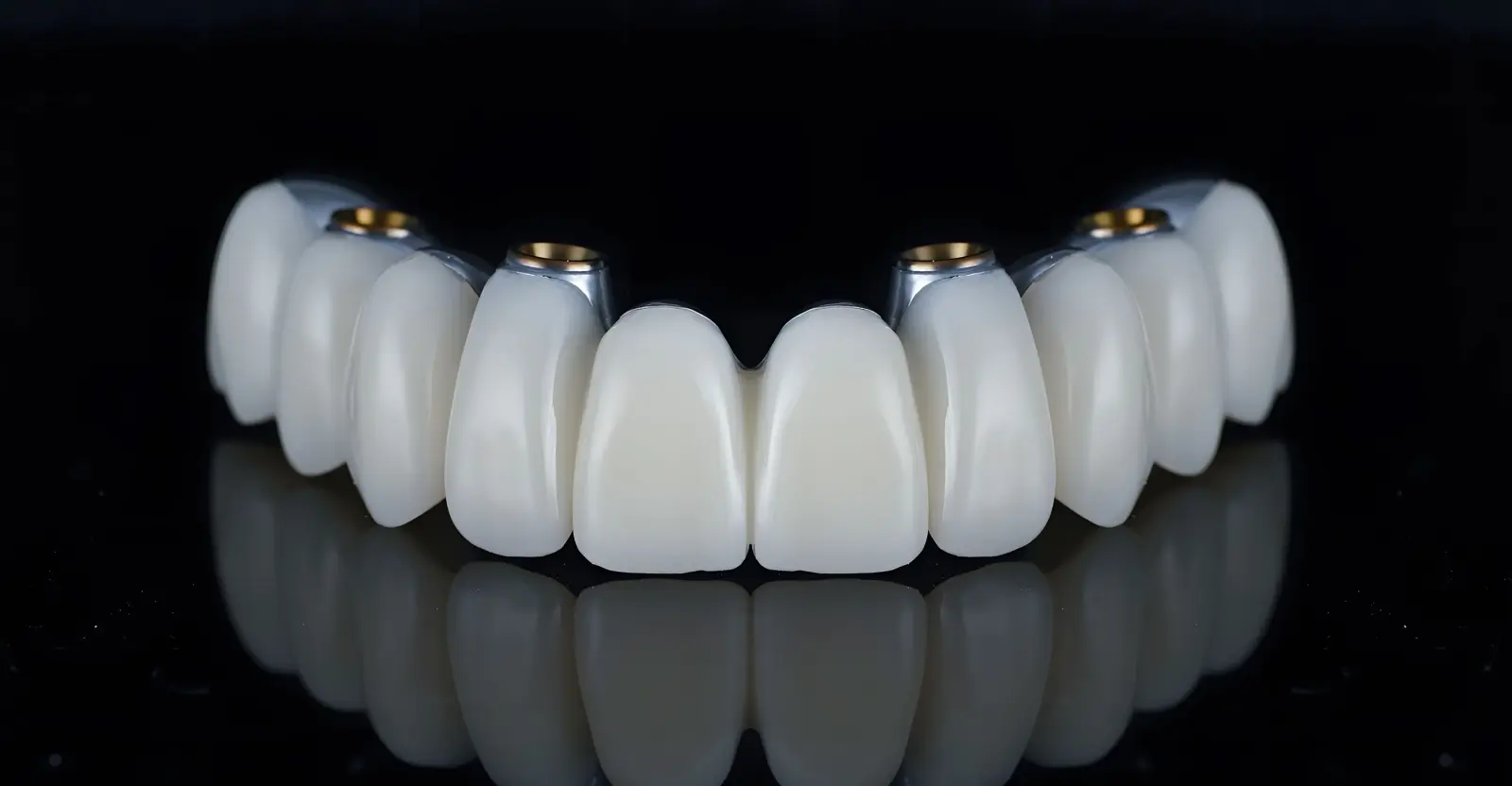 Multiple Teeth Implants Hero - Implant and Facial Surgery
