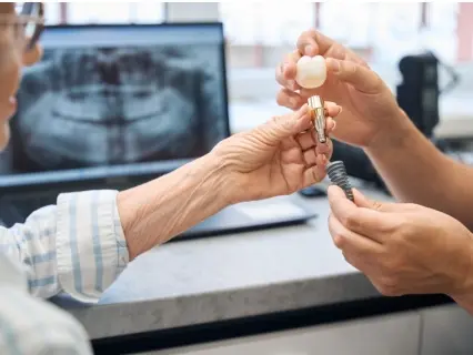 Preparing for Full Mouth Impants - Implant and Facil Surgery Preparing for Full Mouth Impants - Implant and Facil Surgery