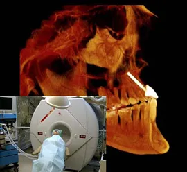 Intra-Operative CT Scanner for Dental Implants